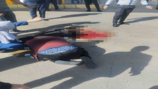 Otobüsün altında kalan hamile kadının bacağı koptu