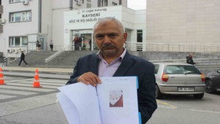 Yaptırdığı implant kabusu oldu