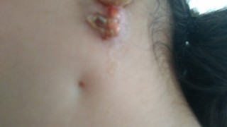 Ailesi kızlarının hastalığına çare arıyor