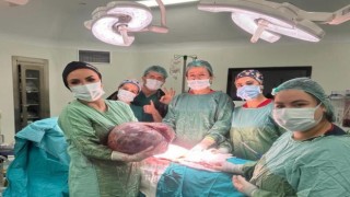 Karın şişkinliği şikayetiyle gittiği hastanede karnından 20 kiloluk kitle çıktı