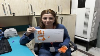Lösemide erken tanı ve tedavi ile yüzde 85‘in üzerinde başarı sağlanıyor