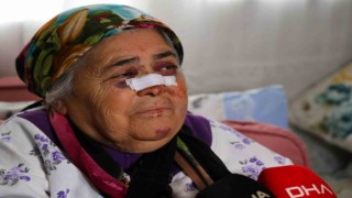 Otomobilin çarptığı yaşlı kadın: Gözümün içine bakıp kaçtı