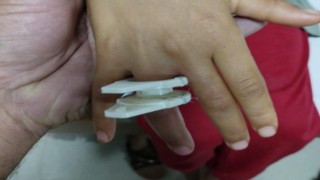 Parmağına plastik parçası sıkışan çocuğu itfaiye kurtardı