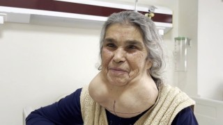 Doktordan korktuğu için yıllarca devasa kitleyle yaşadı
