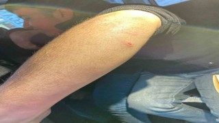 Siirtte oto sanayisinde sokak köpeklerinin saldırdığı genç yaralandı