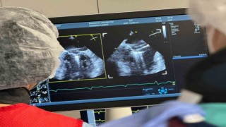 Denizlide ilk defa ameliyatsız mitral kapak yetmezliği tamiri yapıldı