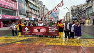 Dünyada 2 milyondan fazla kişi diyaliz tedavisi görüyor