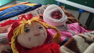 İsrailin saldırılarında yüzü yanan 4 yaşındaki Seca, tedavi için bekliyor