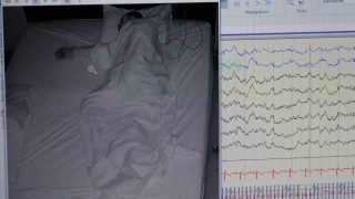 Klinik Nörofizyoloji Uzmanı Leba: Uyku hastalığı kişinin ömrünü kısaltır