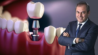 Eksik Diş Sağlık İçin Büyük Tehlike
