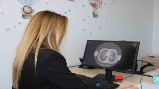 Uzmanı, kistik fibrozis hastalığında erken tanının önemine dikkat çekti