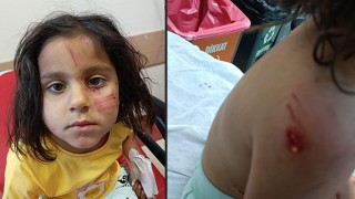 Başıboş köpeklerin saldırısına uğrayan çocuk yaralandı