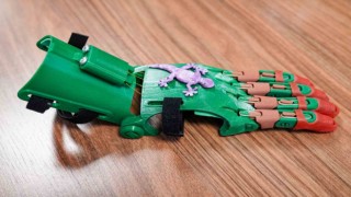 Büyükşehir çocuklara robot el ile umut olacak