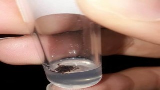 Konyada bir mahallede 3 kişiye kene yapıştı