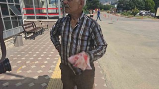 Kurban keseyim derken parmaklarını kesti