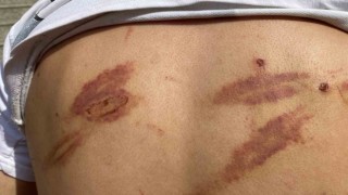 Öldüresiye darp edilmişti, yaşadıklarını anlattı