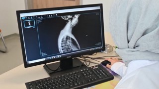 Osmaniye Devlet Hastanesi'nde 3 Boyutlu Skolyoz Tedavisi Uygulanıyor