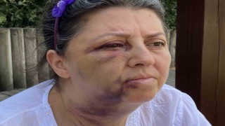 Küçükçekmecede kedi besleyen iki kız kardeşi komşularının saldırısına uğradı