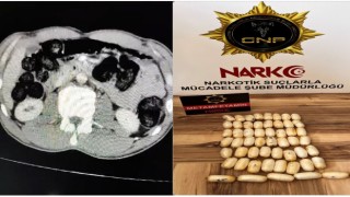 Yabancı uyruklu şahsın midesinden 53 paket uyuşturucu çıktı