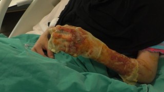 Mangal ateşine dezenfektan döken çift dehşeti yaşadı: Eşim ateşi harlamak istedi, lütfen acele etmeyin