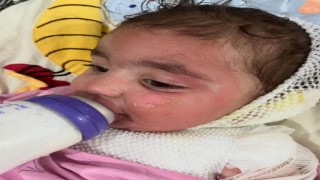 Kreşte çocuğun üzerine kahve döküldü