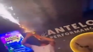 Şov için klarnetine taktığı konfeti ile kendini yaktı