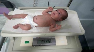 895 gram doğan Güneş bebek hayata tutundu