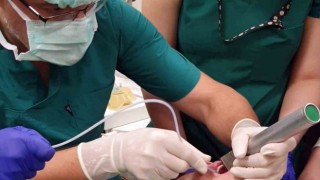 Doç. Dr. Tartar: Yabancı cisim aspirasyonu 1-3 yaş arası çocuklarda sık görülüyor
