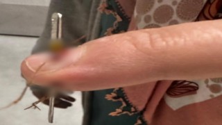 Eline dikiş iğnesi saplanan kadın hastanelik oldu