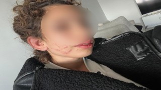 Konyada 19 yaşındaki kızı darp eden gençten “kendi kendini yaraladı” savunması