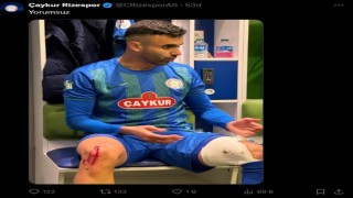 Çaykur Rizespor, Rachid Ghezzalın darbe alan ayağının fotoğrafını paylaştı