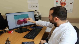 300 gramlık prostat dokusu başarıyla çıkarıldı