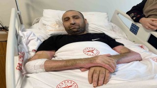 Mangal yapmak isterken Tiner faciası: Vücudunun yüzde 80i yandı, patlamanın şiddeti kameraya yansıdı