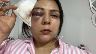 Yürürken saldırıya uğrayan genç kız konuştu: Psikolojim altüst oldu