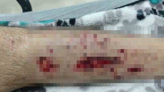 Evinin yolunu karıştıran Alzheimer hastası adam köpeklerin saldırısına uğradı