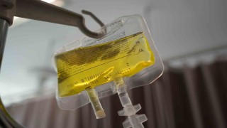 Sarı serum uyarısı: Ciddi alerjik reaksiyon yapıyor, ölümle sonuçlanıyor