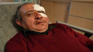 Aile Sağlığı Merkezi önünde darp edilen doktor hastanelik oldu: Bu muamele hakkımız değil