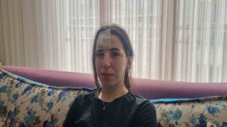 Esenyurtta başıboş köpekler bir kadına saldırdı