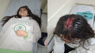 Hakkaride başına buz kütlesi düşen genç kız yaralandı