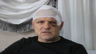 Öldüresiye darp edilen tekel bayii işletmecisi yaşadığı dehşeti anlattı