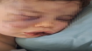Vahşeti yaşayan 2 yaşındaki bebek hastanelik oldu