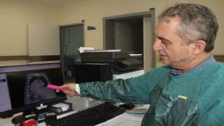 Giresundan dünya tıbbına yeni tanı: Karadeniz sendromu