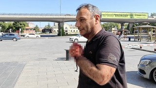 Kayseride acemi kasaplar soluğu acil serviste aldı