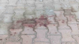Komşusunun balkonundan kendi evine geçmeye çalışırken düşen kadın ağır yaralandı