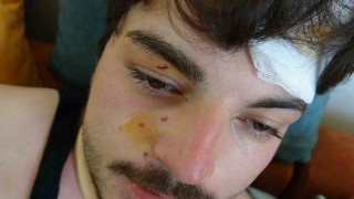 Trafikte darbedilen oyuncu Mehmet Akif Akdeniz yaşadığı dehşeti anlattı