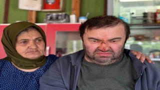 Yüzde 90 engelli vatandaş acımasızca darp edildi