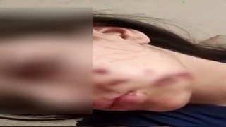 Yüzüne maytap isabet eden genç kız yaralandı