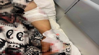 Abdest almak için bahçeye çıkan kadına köpekler saldırdı