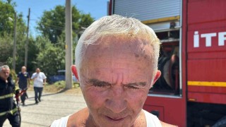 Çöpleri yakmak isterken kendini de yaktı