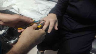 Kadının parmağına sıkışan yüzük, itfaiye ekibince hastanede çıkarıldı